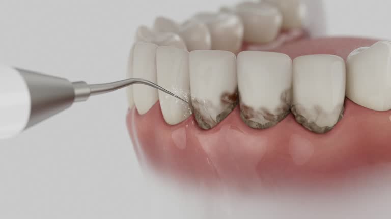 Reliable Dental Implants contractor in Walker Mill, MD by Smile Center Dentistry